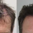 Business 36 image RAHAL HAIR TRANSPLANT TORONTO Health & Medicine in North York ON