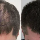 Business 37 image RAHAL HAIR TRANSPLANT TORONTO Health & Medicine in North York ON