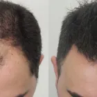Business 39 image RAHAL HAIR TRANSPLANT TORONTO Health & Medicine in North York ON