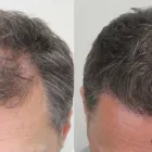 Business 40 image RAHAL HAIR TRANSPLANT TORONTO Health & Medicine in North York ON
