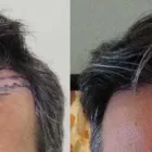 Business 41 image RAHAL HAIR TRANSPLANT TORONTO Health & Medicine in North York ON