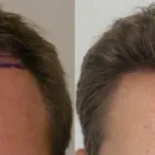 Business 42 image RAHAL HAIR TRANSPLANT TORONTO Health & Medicine in North York ON