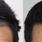 Business 43 image RAHAL HAIR TRANSPLANT TORONTO Health & Medicine in North York ON