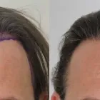 Business 7 image RAHAL HAIR TRANSPLANT TORONTO Health & Medicine in North York ON