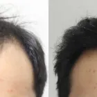 Business 45 image RAHAL HAIR TRANSPLANT TORONTO Health & Medicine in North York ON