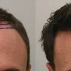 Business 8 image RAHAL HAIR TRANSPLANT TORONTO Health & Medicine in North York ON