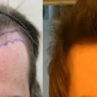 Business 48 image RAHAL HAIR TRANSPLANT TORONTO Health & Medicine in North York ON