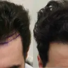 Business 49 image RAHAL HAIR TRANSPLANT TORONTO Health & Medicine in North York ON
