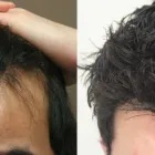 Business 50 image RAHAL HAIR TRANSPLANT TORONTO Health & Medicine in North York ON