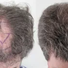 Business 9 image RAHAL HAIR TRANSPLANT TORONTO Health & Medicine in North York ON