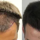 Business 10 image RAHAL HAIR TRANSPLANT TORONTO Health & Medicine in North York ON