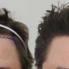 Business 11 image RAHAL HAIR TRANSPLANT TORONTO Health & Medicine in North York ON