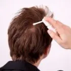 Business 3 image REMPLACEMENT CAPILLAIRE MONTREAL Wigs & Hairpieces in Dollard-des-ormeaux QC