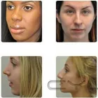 Entreprises 1 image REVESSE RHINOPLASTY & FACIAL COSMETIC SURGERY Plastic & Cosmetic Surgery dans Scarborough ON