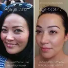 Business 5 image SACHEEN'S SKINCARE SOLUTIONS Skin Care Clinics & Services in Kelowna BC