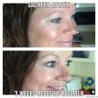 Business 2 image SACHEEN'S SKINCARE SOLUTIONS Skin Care Clinics & Services in Kelowna BC