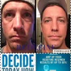 Business 10 image SACHEEN'S SKINCARE SOLUTIONS Skin Care Clinics & Services in Kelowna BC