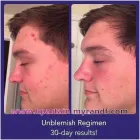 Business 11 image SACHEEN'S SKINCARE SOLUTIONS Skin Care Clinics & Services in Kelowna BC