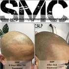 Entreprises 5 image SCALP MICROPIGMENTATION TRAINING CENTER Wigs & Hairpieces dans Toronto ON