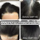 Business 5 image SCALP MICROPIGMENTATION TRAINING CENTER Health & Medicine in Toronto ON