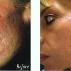 Business 5 image SENSEI LASER & VEIN REJUVENATION LTD Weight Loss Centres in West Kelowna BC