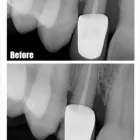 Business 34 image SIMON FRASER DENTAL CENTRE Health & Medicine in Burnaby BC
