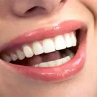 Business 36 image SIMON FRASER DENTAL CENTRE Health & Medicine in Burnaby BC