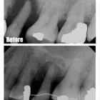 Business 6 image SIMON FRASER DENTAL CENTRE Health & Medicine in Burnaby BC