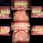 Entreprises 9 image SONE'S ON SHEPPARD DENTAL CENTRE Health & Medicine dans Scarborough ON