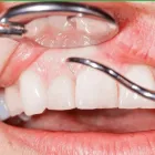 Business 8 image SOUTH TRAIL CROSSING DENTAL Family Dentistry in Calgary AB
