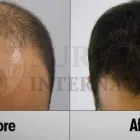 Business 4 image SURE HAIR INTERNATIONAL Hair Loss Treatments & Clinics in Toronto ON