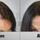 Business 5 image SURE HAIR INTERNATIONAL Hair Loss Treatments & Clinics in Toronto ON