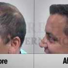 Business 7 image SURE HAIR INTERNATIONAL Hair Loss Treatments & Clinics in Toronto ON