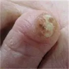 Entreprises 1 image THE FOOT NURSE Nail Salons & Technicians dans Kelowna BC
