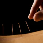 Business 24 image THERAPEUTIC BODY CONCEPTS Massage Therapists in Edmonton AB