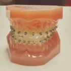 Business 3 image TOOTH BLEACHING RICHMOND HILL Health & Medicine in Richmond Hill ON
