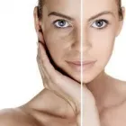 Business 4 image TRINITI LASER CLINIC Skin Care Clinics & Services in New Westminster BC