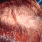 Business 8 image WEST COAST WIGS & REAL HAIR LOSS STUDIO Wigs & Hairpieces in North Vancouver BC