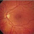 Business 4 image WEST VANCOUVER OPTOMETRY CLINIC Ophthalmologists, Optometrists & Opticians in West Vancouver BC