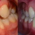 Business 1 image WHISTLER ORTHODONTIC CENTER Orthodontists in Whistler BC