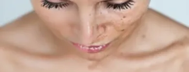 Business 3 image ADVANCED ELECTROLYSIS LASER Hair Consultants in Belleville ON