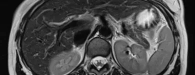 Entreprises 1 image AIM MEDICAL IMAGING Hospitals dans Vancouver BC