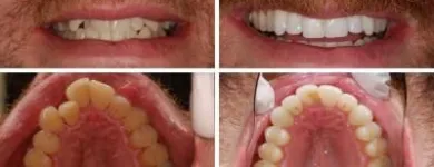 Business 1 image CARLETON CAB travel & tourism in Saint John NB