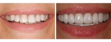 Business 4 image CARLETON CAB travel & tourism in Saint John NB