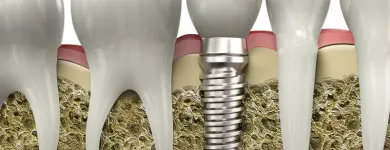 Business 1 image CORNERSTONE DENTAL CENTRE Family Dentistry in Langley BC