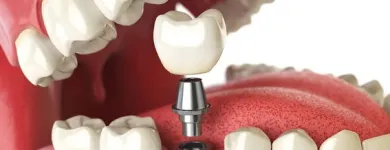 Business 13 image CRESCENT HEIGHTS DENTAL CLINIC Family Dentistry in Calgary AB