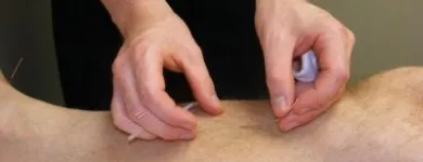 Entreprises 8 image EVOLUTION WELLNESS CENTRE Massage Therapists dans Langley BC