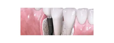 Business 2 image HUMMINGBIRD DENTAL CLINIC - FAMILY DENTIST OPEN FOR REGULAR BUSINESS SERVING RICHMOND HILL in Richmond Hill ON