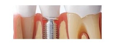 Business 4 image HUMMINGBIRD DENTAL CLINIC - FAMILY DENTIST OPEN FOR REGULAR BUSINESS SERVING RICHMOND HILL in Richmond Hill ON