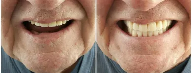 Business 2 image KELOWNA DENTURE CLINIC Health & Medicine in Kelowna BC